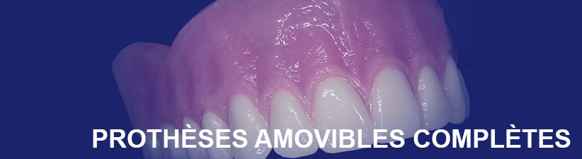 Prothèse complètes amovibles | Laboratoire dentaire Gati