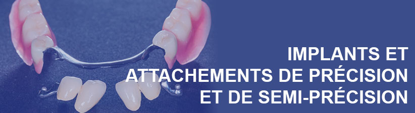 Implants et attachements de précision | Laboratoire dentaire Gati